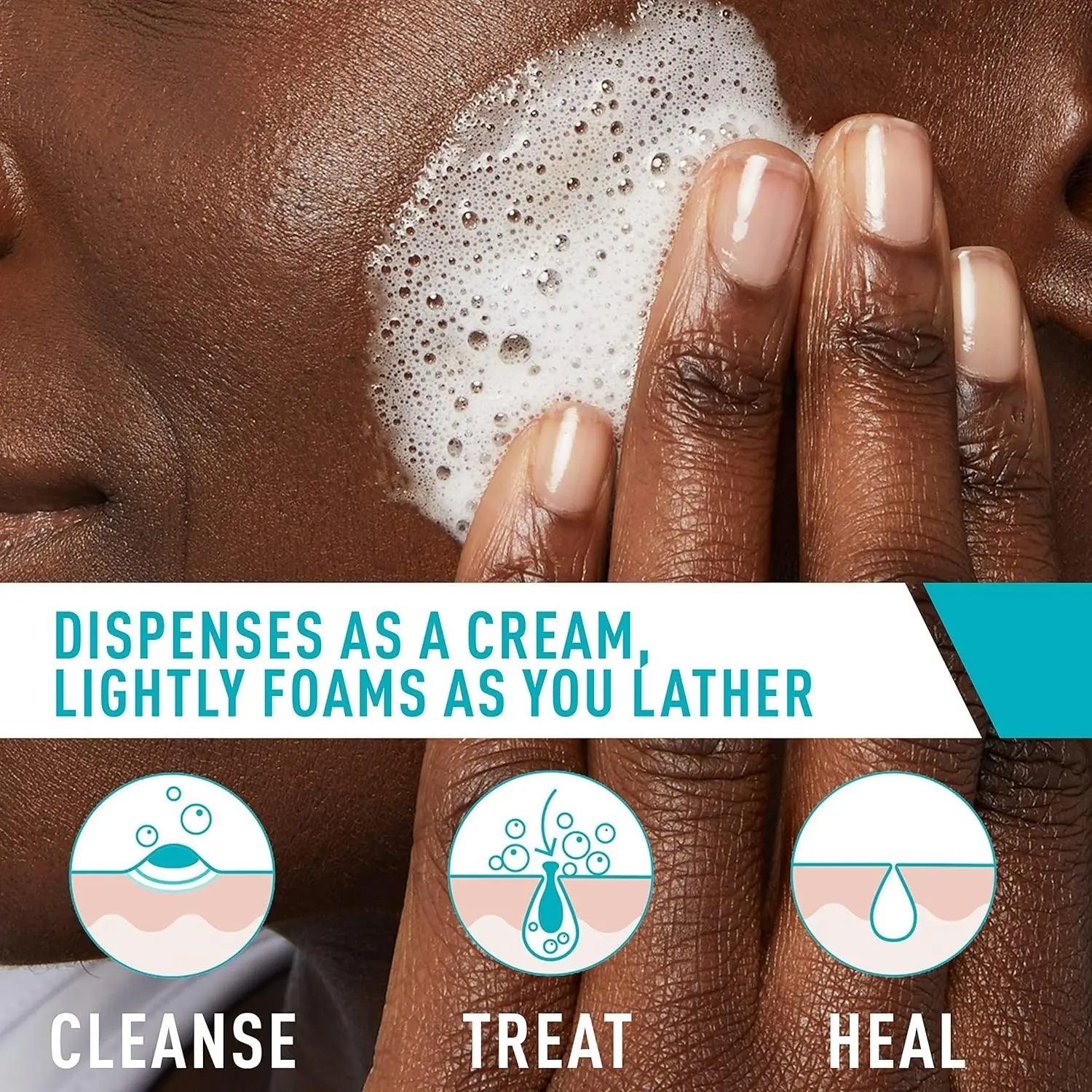 Natural skin care Products- CeraVe Acne and da - Nutragole
